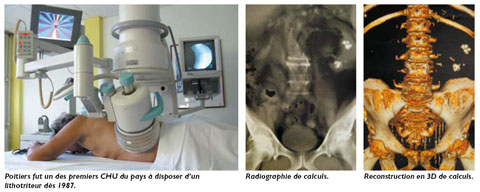 bloc uro